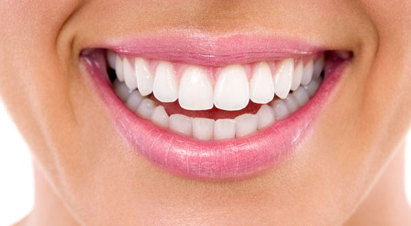 teeth whitening after 1