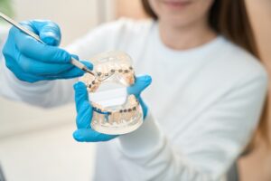 dentist in Katy TX comparing Invisalign aligners and traditional braces during consultation