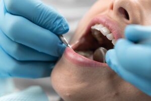 dentist in Katy TX performing routine dental checkup and cleaning