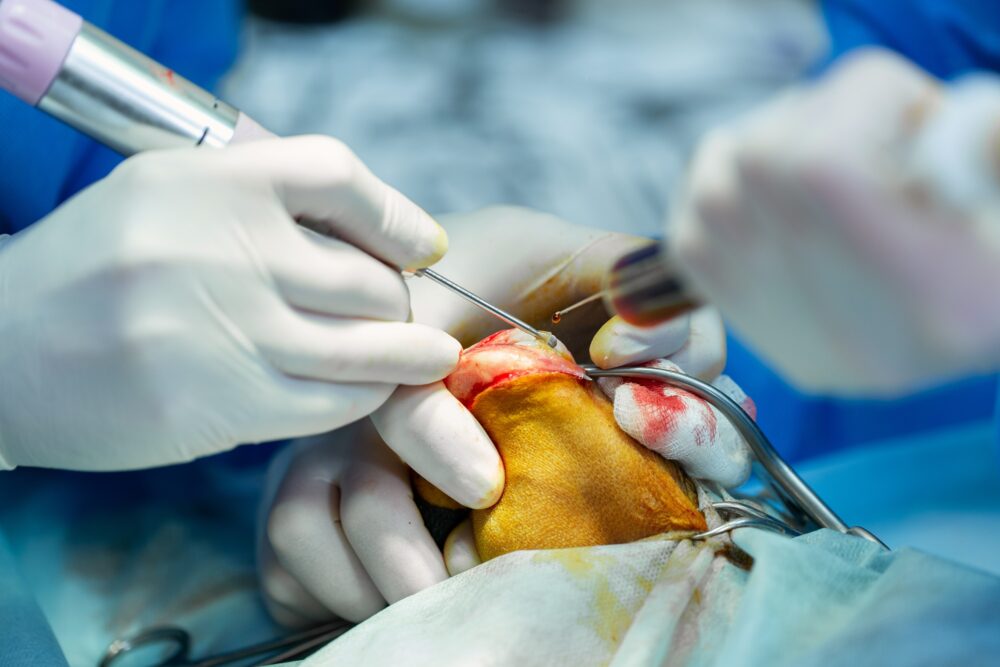 Root Canal Treatment in Katy, TX