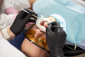 Dentist providing cavity filling treatment to a patient in Katy TX
